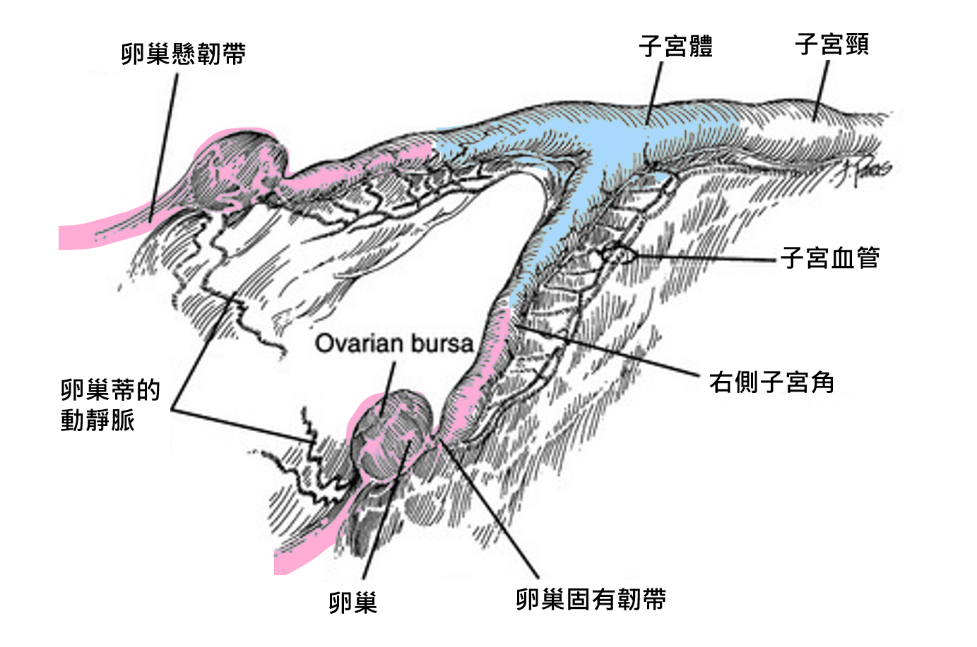 子宮卵巢摘除(ovariohysterectomy)就是把紅色和藍色的部分都切除。 我們使用腹腔鏡的方式,將兩側卵巢和近端子宮角(紅色部分)處理好,然後將它們連同子宮體(藍色部分)一起拉出腹腔後結紮。